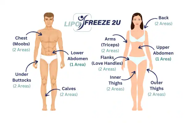 Areas you can have fat freezing treatment Richmond