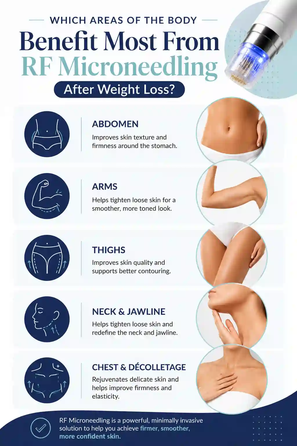 Which Areas of the Body Benefit Most From RF Microneedling After Weight Loss Richmond