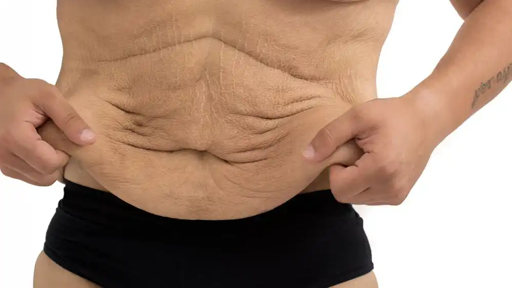RF Microneedling for Loose Skin: How Can It Help Tighten and Reshape the Skin Richmond?